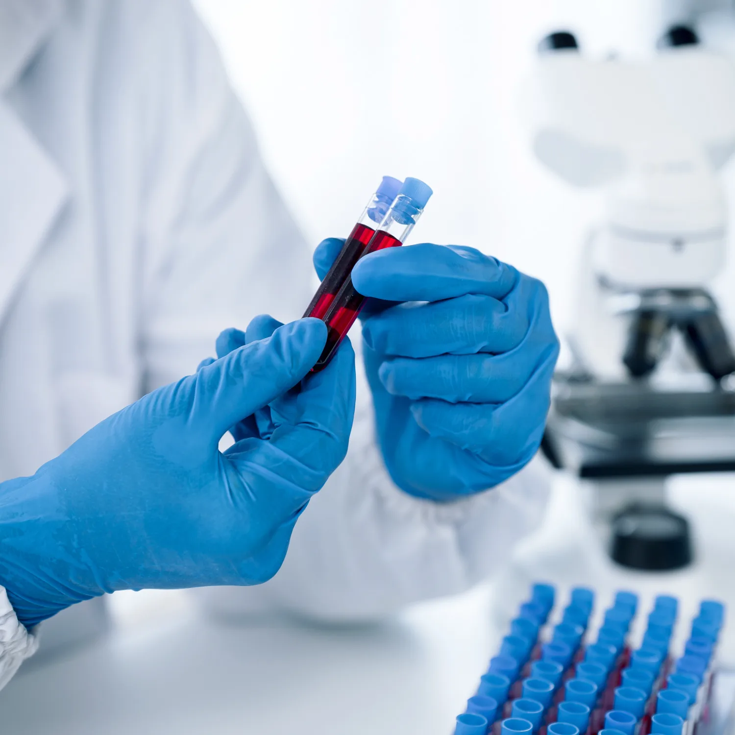 Blood tests