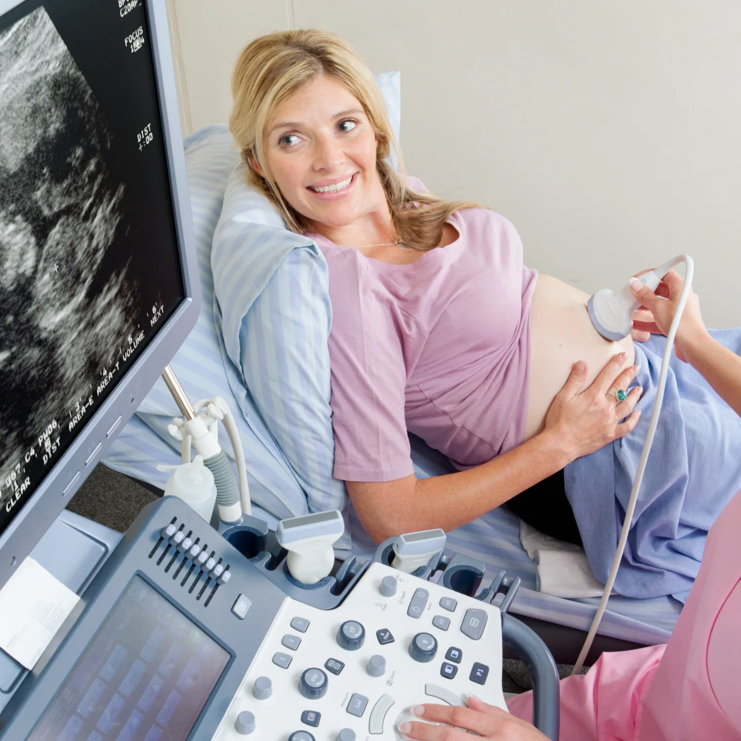 General ultrasound