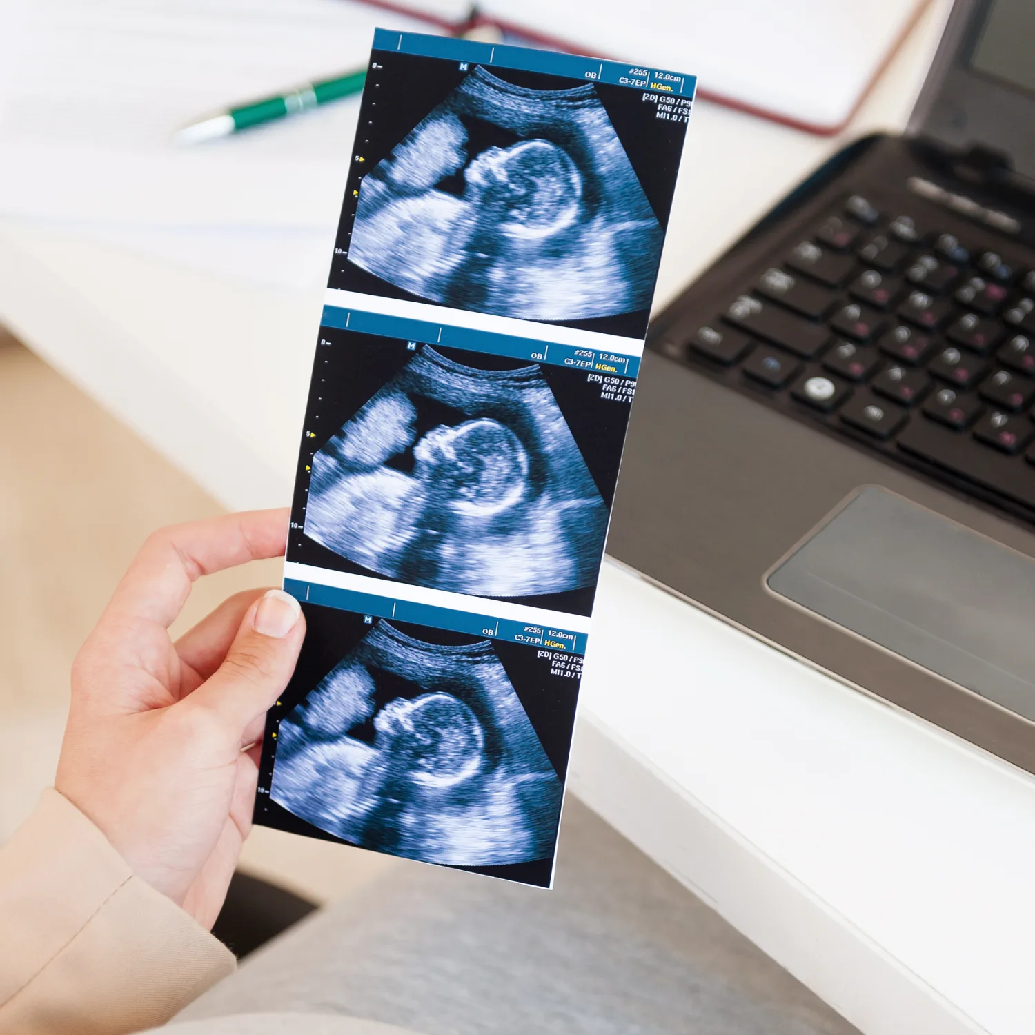 Pregnancy scans